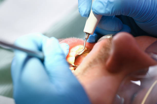 Best Weekend Emergency Dentist in Oak Ridge, TN