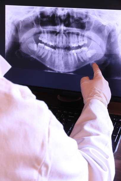 Best Emergency Dentist for Knocked-Out Tooth in Oak Ridge, TN