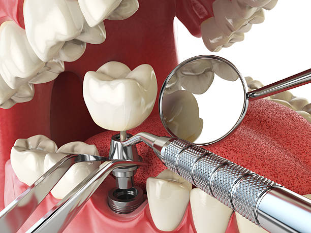 Best Holiday Emergency Dentist in Oak Ridge, TN