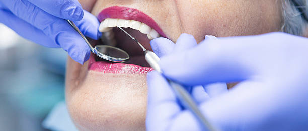 Best Emergency Root Canal Treatment in Oak Ridge, TN
