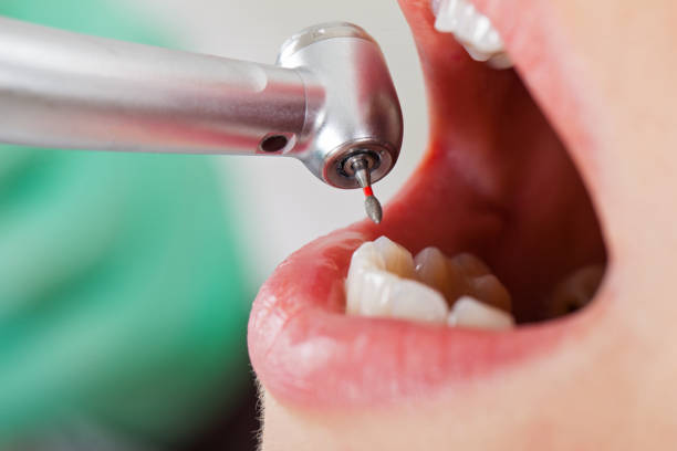 Best Emergency Dental Services for Seniors in Oak Ridge, TN